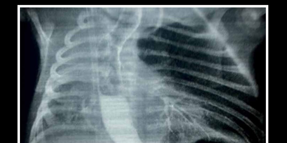 volumen8-numero1-revista-interciencia.jpg portada-interciencia-volumen8-n1